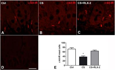 Chronic Exposure to Cigarette Smoke Affects the Ileum and Colon of Guinea Pigs Differently. Relaxin (RLX-2, Serelaxin) Prevents Most Local Damage